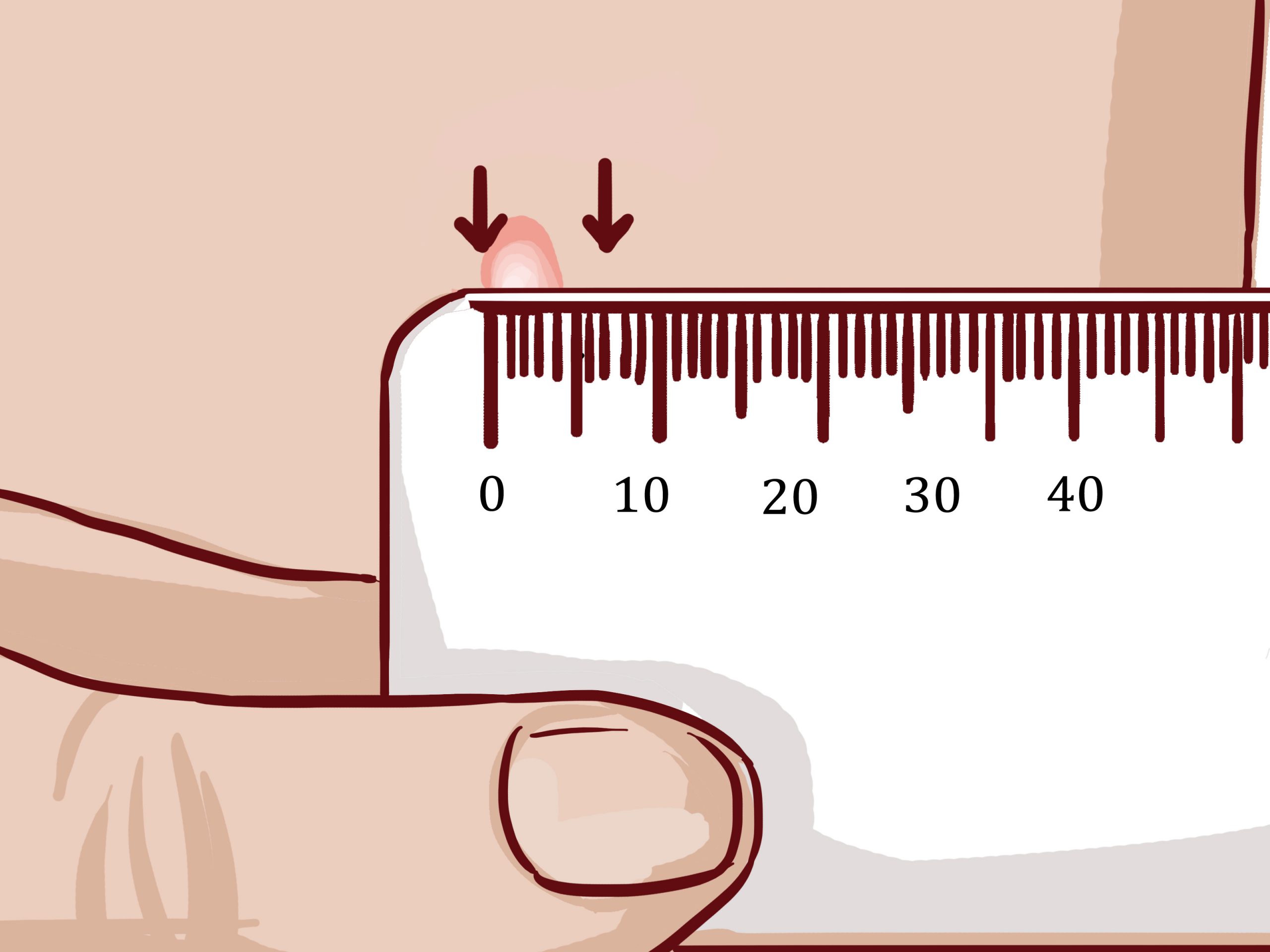 Actual Size Downloadable Tb Skin Test Ruler Printable